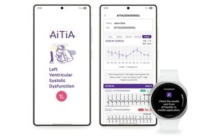 تشخیص زودهنگام نارسایی قلبی و ارتقای سلامت روان با فناوری‌های پوشیدنی سامسونگ